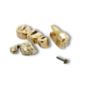 Gold & Silber Ankauf in Traunreut und Umgebung,Traunstein,Trostberg,Altenmarkt an der Alz,Grassau,Chieming,Siegsdorf,Waging am SeeBad Endorf,Prien am Chiemsee